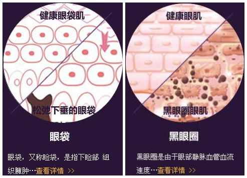 黑眼圈