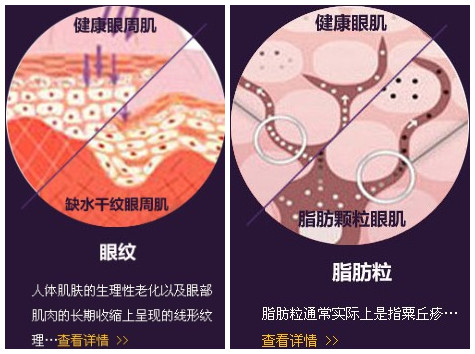 去黑眼圈