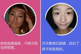 美白针