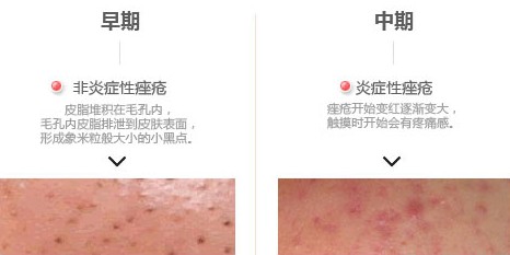 亚韩双效活肤祛痘