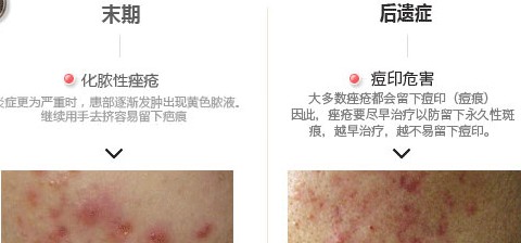 亚韩双效活肤祛痘